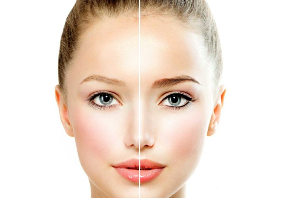میکروپیگمنتیشن چیست؟