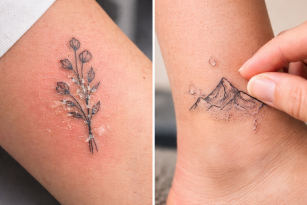 پوسته شدن، خارش و التهاب بعد از تاتو